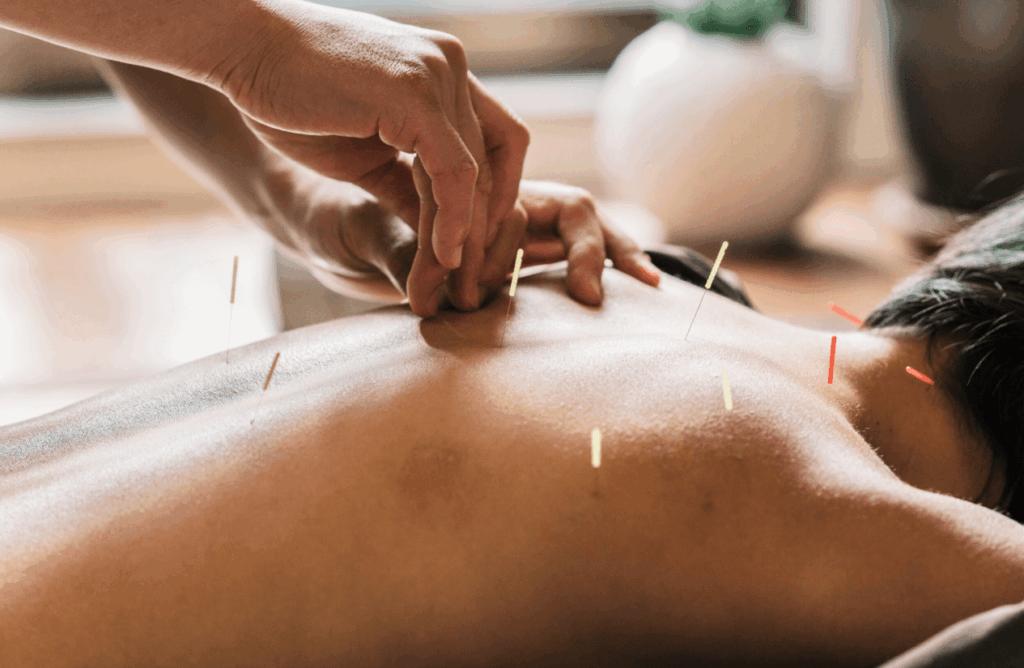 3 Things to Expect From Toronto’s Top Fertility Acupuncture